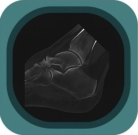 CT ankle anatomy icon